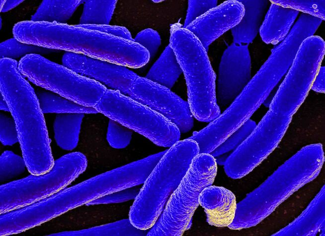 E. coli provoca molto spesso lo sviluppo di cistite nelle donne